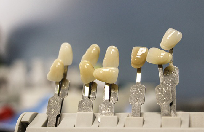 Replacement of missing teeth